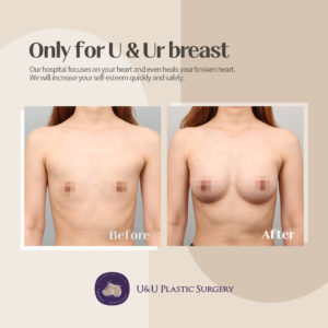 How can I enhance my breasts?