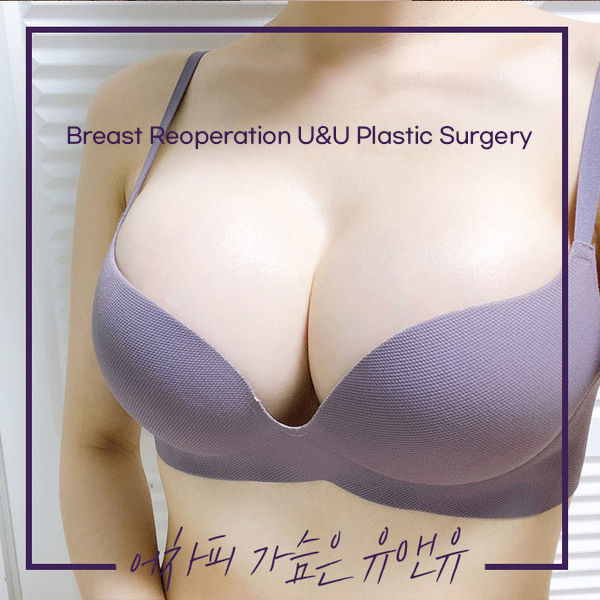 Breast-Reoperation